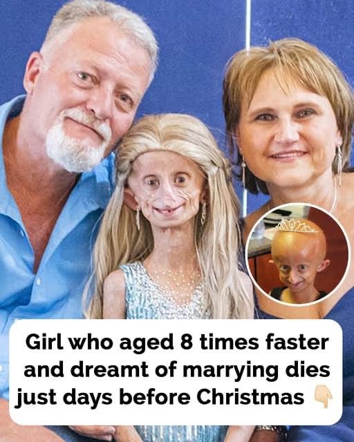 Beandri Booysen: Girl In South Africa With Progeria Dies